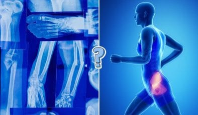 Quiz sulle ossa del corpo umano [VERO o FALSO]